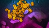 So sieht die Vorstufe des Coronavirus aus. <a href="https://commons.wikimedia.org/wiki/File:SARS-CoV-2_(yellow).jpg" title="via Wikimedia Commons">NIAID</a> / <a href="https://creativecommons.org/licenses/by/2.0">CC BY</a>