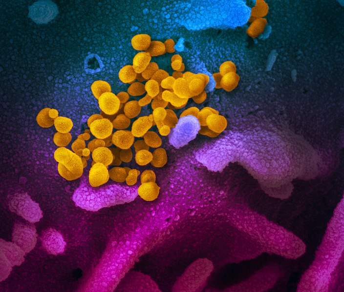 So sieht die Vorstufe des Coronavirus aus. NIAID / CC BY